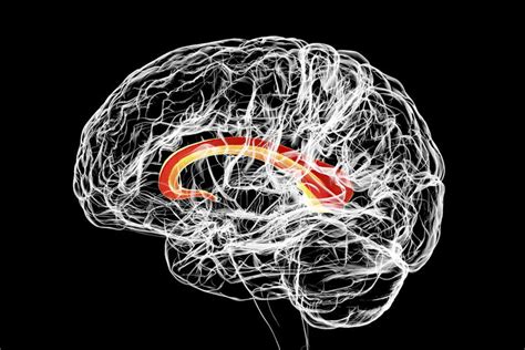 Marchiafava-Bignami Disease: Causes, Symptoms, Treatment