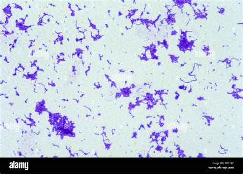 Streptococcus Bacteria Microscope