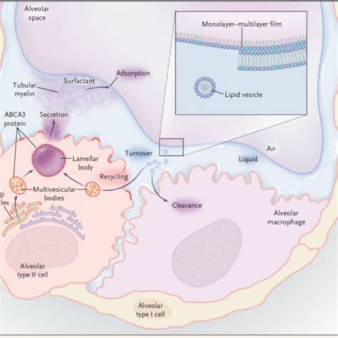 Pedigrees of Patients with Surfactant Deficiency. Solid symbols ...