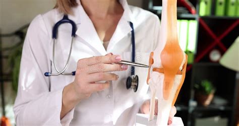The Doctor Shows The Model Of The Human Knee Close Up Stock Footage