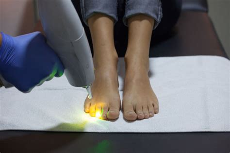 How Lasers Are Being Used To Treat Nail Fungus Lss Laser Service