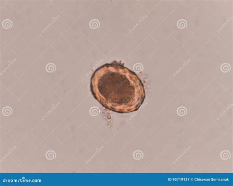 Ascaris Lumbricoides Egg In Stool Exam Stock Image Image Of