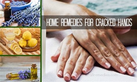 20 Top Natural Home Remedies For Anal Itching