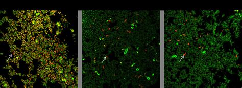 Metabolic activity of C. auris cells in biofilm decreases with ... 