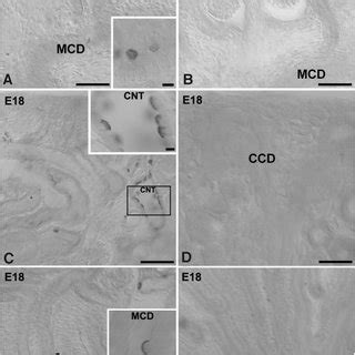 Light Micrographs Of 50 M Thick Vibratome Sections From Prenatal E13