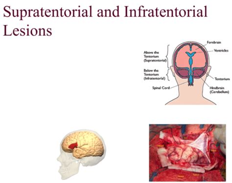 Pathophysiology Ch 15 16 And 17 The Nervous System Flashcards Quizlet