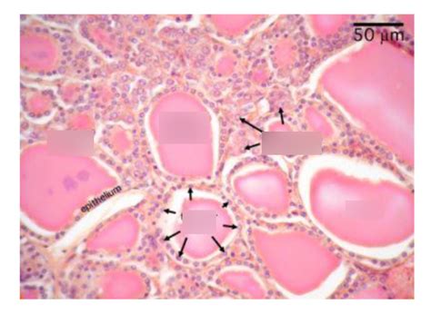 Thyroid Histology C Cells