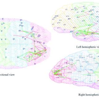 Dynamic Visualization Of The Evolution Of Neuronal Connectivity And