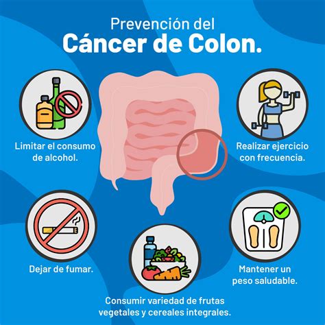 C Ncer De Colon Acudir Emergencias M Dicas