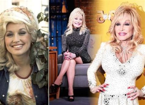 Dolly Parton Plastic Surgery: Her $1Million Appearance