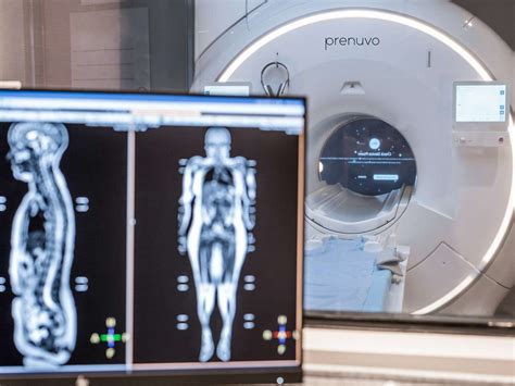 We Tried Prenuvo's $2,500 MRI Scan. Here's What We Learned and Why It's ...