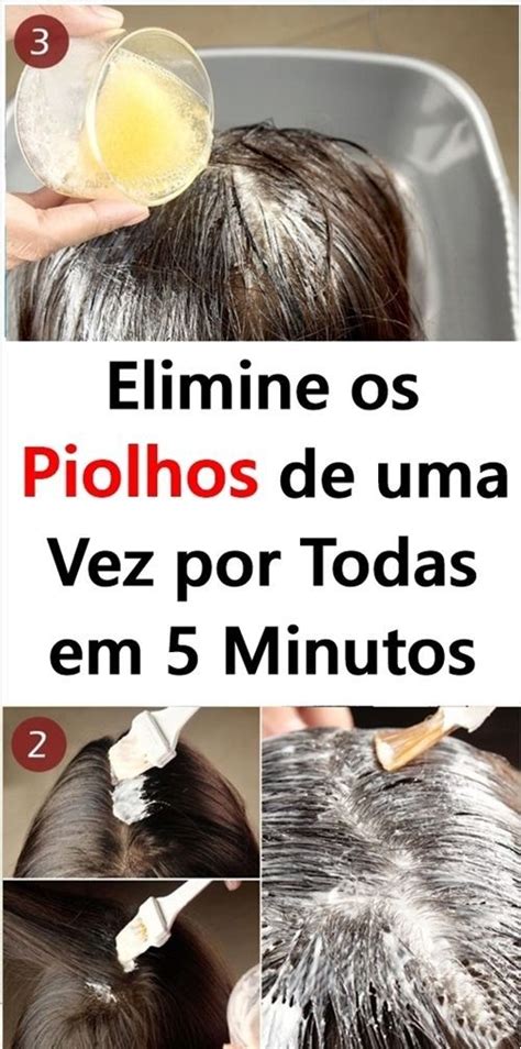 O Que Fazer Para Acabar Os Piolhos De Uma Vez Por Todas Piolhos