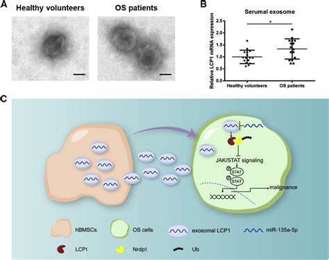 Exosomal Transfer Of Lcp Promotes Osteosarcoma Cell Tumorigenesis And