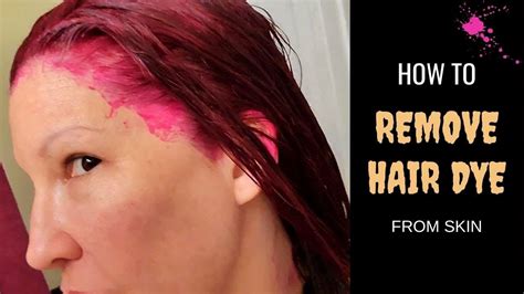 How To Remove Hair Dye Stain From Skin Instantly Fastest Way To Get