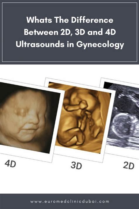 D D Ultrasound In Obstetrics Gynecology And Infertility