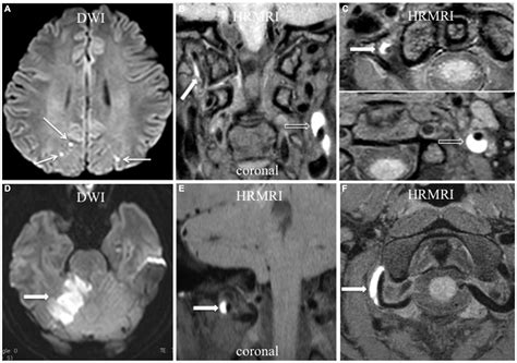 Frontiers Three Dimensional High Resolution Magnetic Resonance