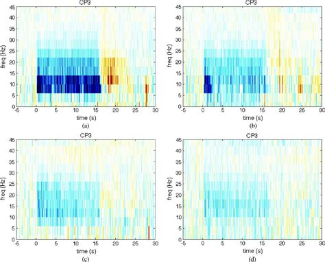 Figure 3 From Combined EEG FNIRS Decoding Of Motor Attempt And Imagery