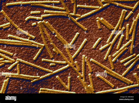 Tobacco Mosaic Virus Stock Photo Alamy