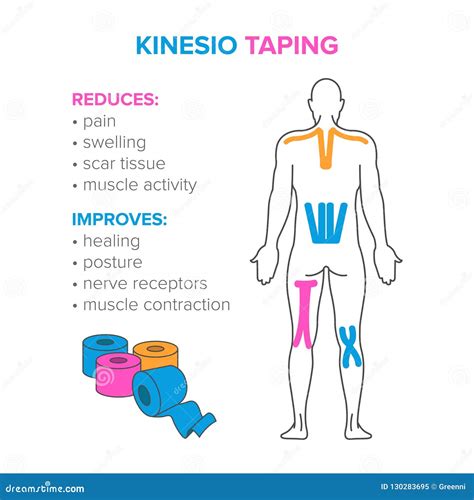 Kinesio Taping Illustration How To Cut And How Using The Kinesiology