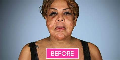 Woman With Cement Injected in Face Gets Help on Botched - Rajee ...