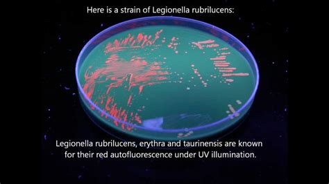 Legionella Colonies On Agar Plates Youtube