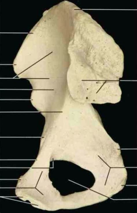 Medial Aspect Right Hip Osteology Diagram Quizlet