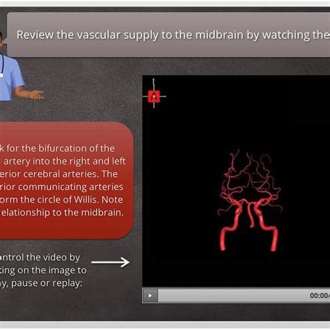 A 3D vascular anatomy review: vascular supply of each brainstem section ...