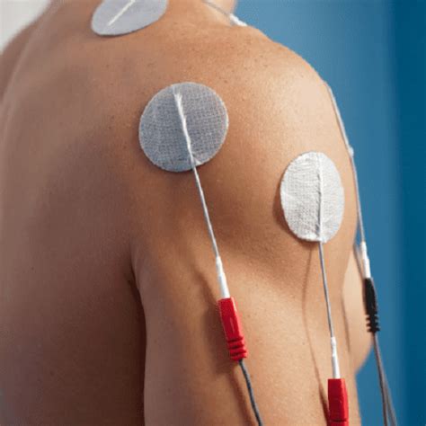 Transcutaneous Electrical Nerve Stimulation Tens Halofisioterapi