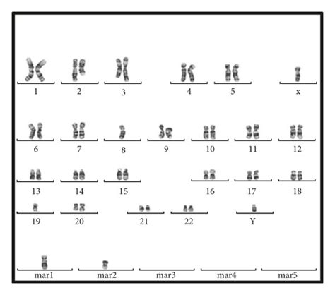 Cytogenetic Characterization A Conventional Karyotype On The Bone