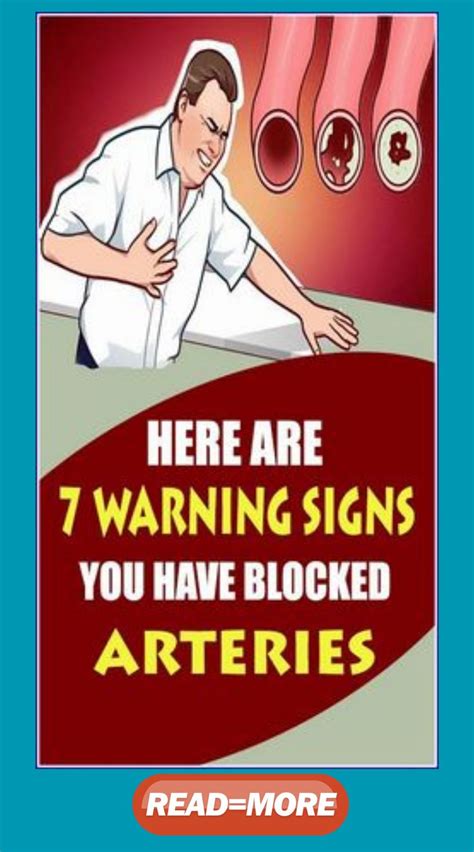 HERE ARE 7 WARNING SIGNS OF CLOGGED ARTERIES AND HOW TO TREAT IT