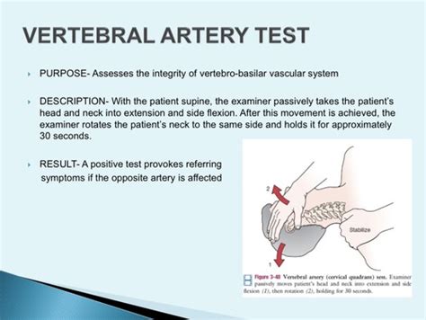 Day 00 Cervical Spine Special Tests Flashcards Quizlet