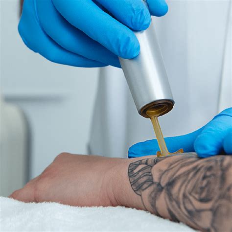 Eliminaci N De Tatuajes Con L Ser Picoway Clinica Tufet Barcelona