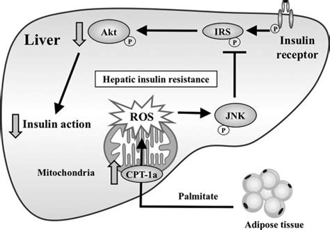 Proposed Model For Palmitate Induced Hepatic Insulin Resistance