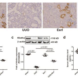 Eeri Alleviates Renal Fibrosis Induced By Uuo In Mice A