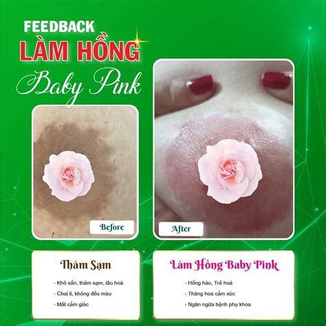 Phun Hồng Nhũ Hoa Ưu Nhược Điểm Hình Ảnh Trước Sau Bảng Giá 2024