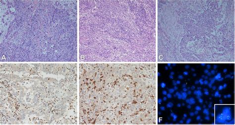 Frontiers The Use Of Immunohistochemistry Fluorescence In Situ