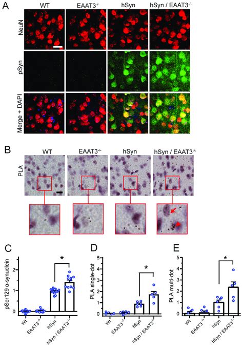 Increased α synuclein aggregation in cortical neurons of hSyn EAAT3