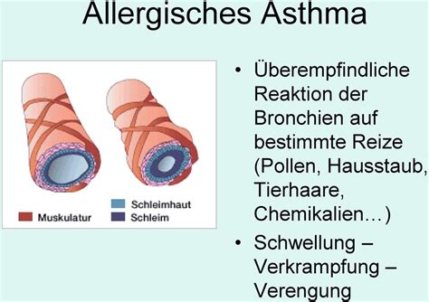 Heuschnupfen Asthma Co Allergien homöopathisch behandeln PDF Free