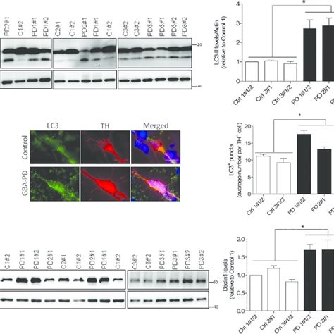 Generation And Characterization Of Ipsc Derived Dopaminergic Neuronal