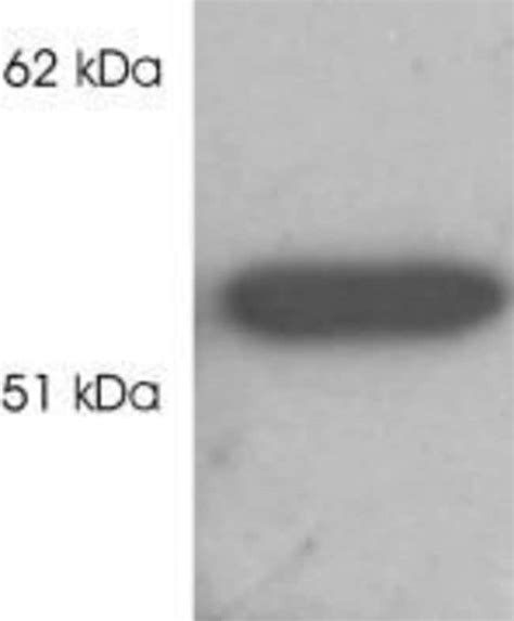 HDAC2 Polyclonal Antibody Invitrogen 100 μg Unconjugated Antibodies