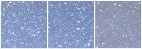 Cell Morphologies Of Rat Bmscs A Ascs B And Bmscs C After The