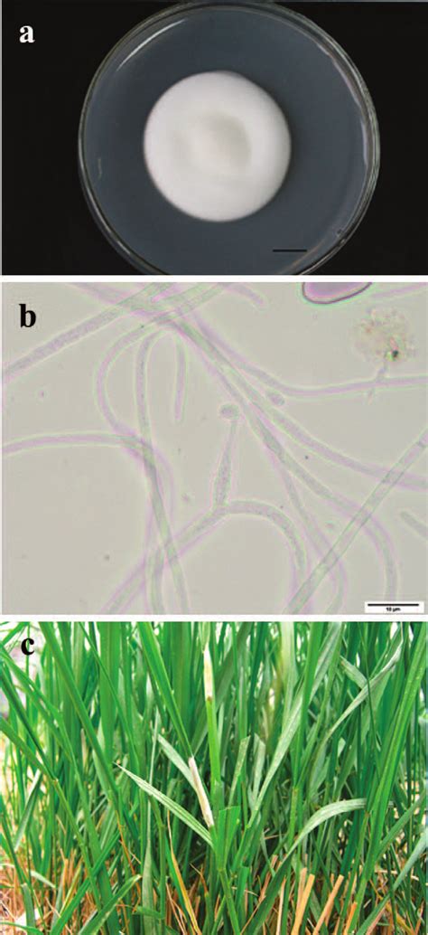 Colony Conidia And Stromata Of Epichloë Gansuensis Isolated From