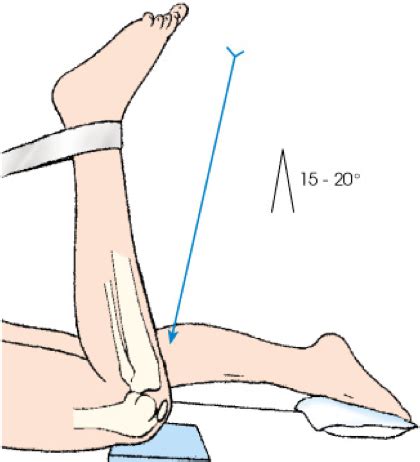 Knee Method Madness Flashcards Quizlet