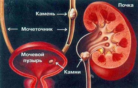 Мочевой пузырь и моча с кровью: лечение, причины