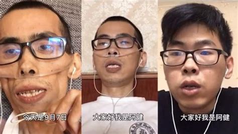 29岁女孩抗癌两年后离世生前丈夫不离不弃陪着她四处旅游 东方养生频道 东方养生