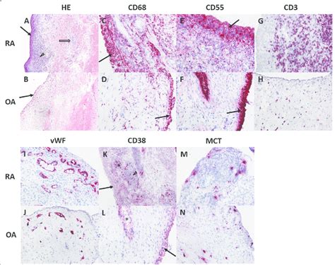 Typical Histologic And Immunohistochemical Staining Patterns Of Ra And Download Scientific