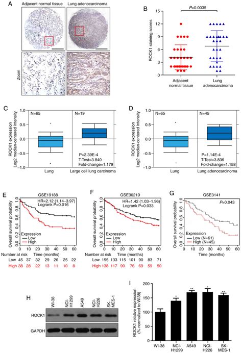 ROCK1 Promotes Migration And Invasion Of Nonsmallcell Lung Cancer