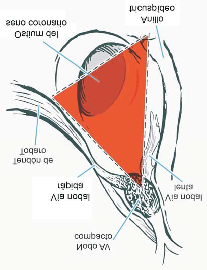 Anatomía Del Triángulo De Koch Extraído De Texto De Cardiología Download Scientific Diagram