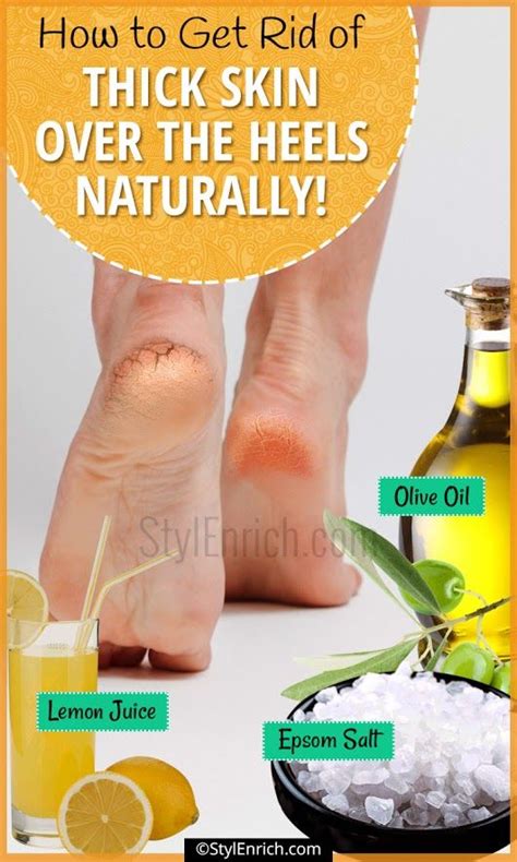 How To Remove Dead Skin From Feet Using Natural Remedies Dead Skin