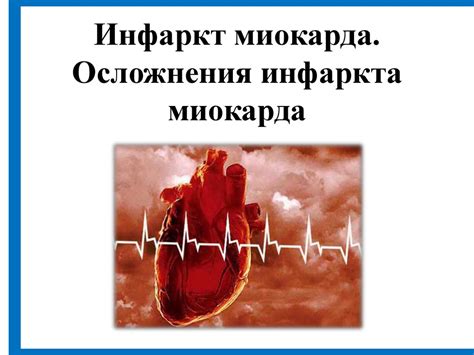 Инфаркт миокарда. Осложнения инфаркта миокарда - презентация онлайн